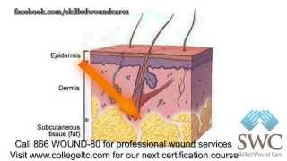 Wound Care 101 [upl. by Godart]